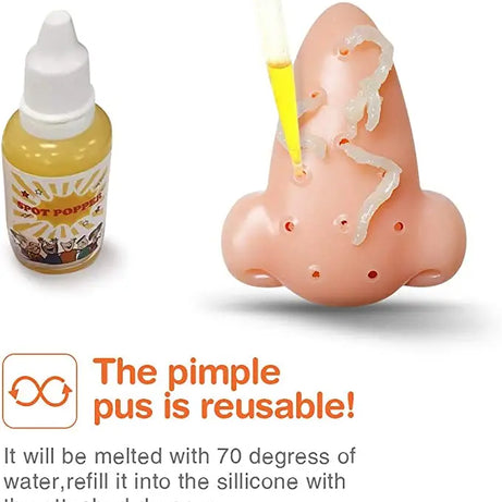 Squishy Pimple Popper – Stress comfort Toy