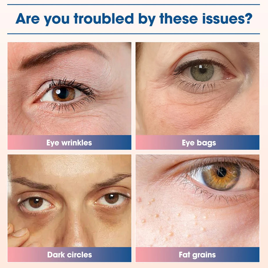 EMS Electric Eye Massager for Women Home Use Beauty Product with Red Light Therapy for Eye Massage Reduce Dark Circles Eye Bags